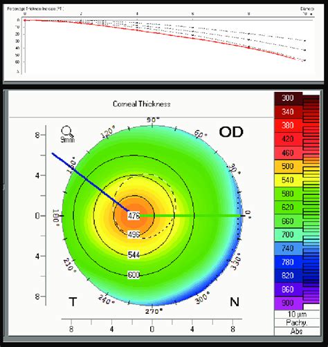 measurement of the thickness of the cornea is known as|average corneal thickness range.